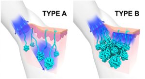 Anatomical comparison of sweat gland structures and energy penetration levels