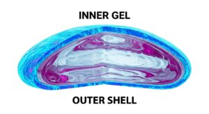 Cross-section of an ergonomic silicone breast implant showing the internal gel and outer shell layers.