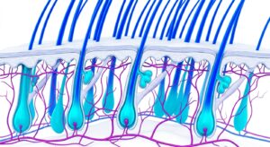 3D medical illustration of male hair follicle anatomy and M-shaped recession pattern